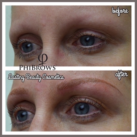 Microblading Alopecia eyebrows by Lasting Beauty Cosmetics